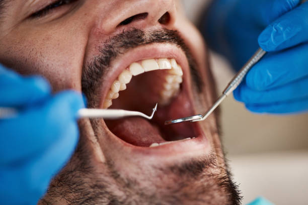 Emergency Dental Services in Shady Hollow, TX